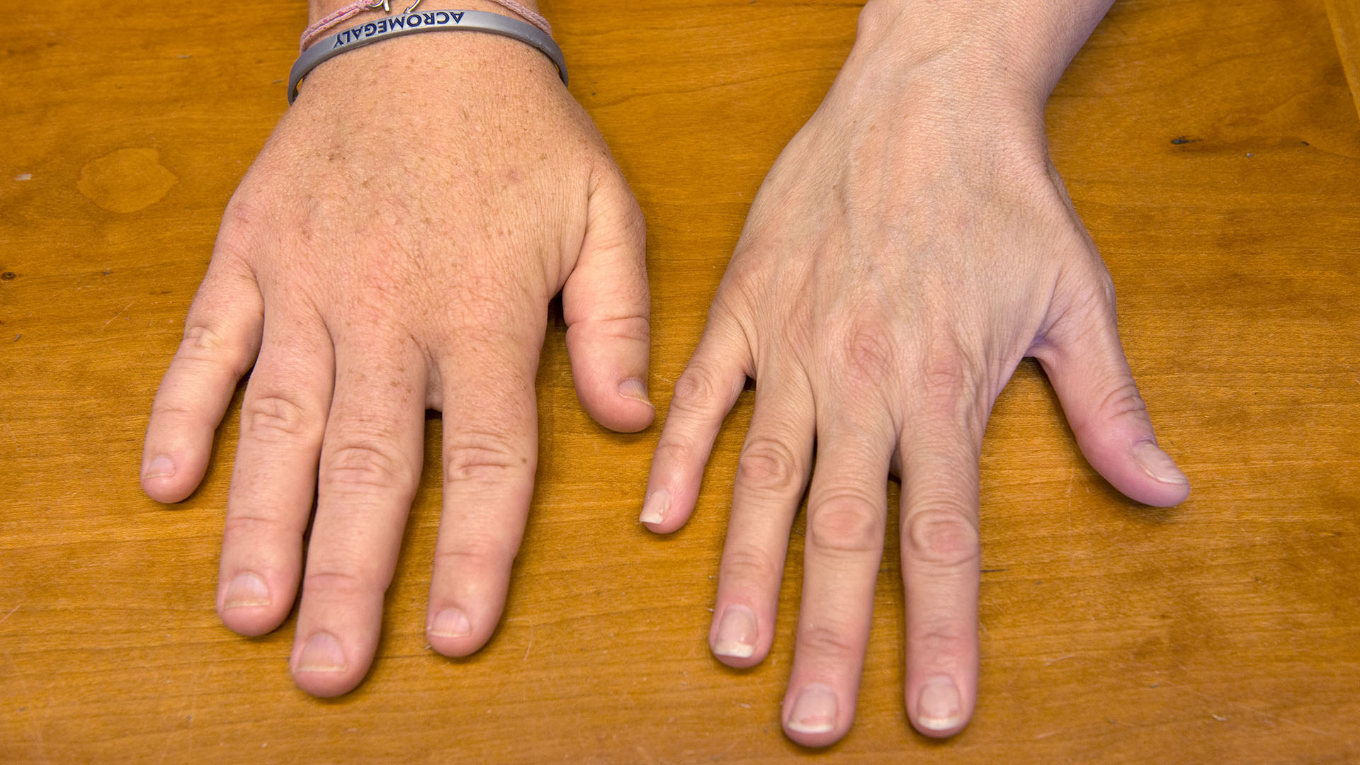 2Hands